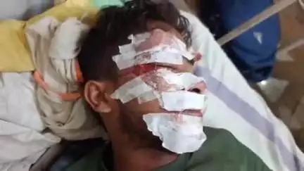 टीकमगढ़: टीकमगढ़-झांसी हाइवे पर सड़क हादसे में युवक घायल, स्थानीय लोगों ने पहुंचाया अस्पताल