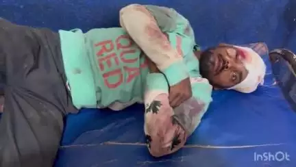 रोह: रोह कादिरगंज रोड में गाड़ी की चपेट में आने से एक युवक जख्मी, अस्पताल में कराया गया भर्ती
