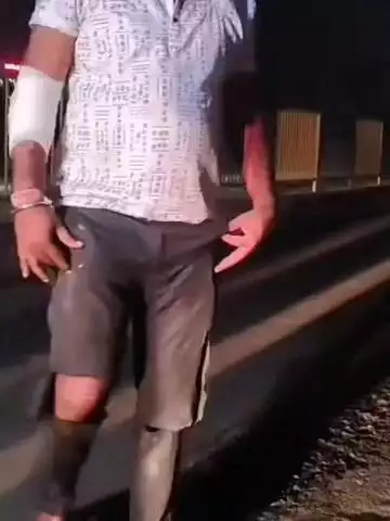 अलवर: लोहिया का तिवारा से बागड़ तिराहे के बीच हुए हादसे में दो घायलों ने NHAI पर उद्योग नगर थाने में दर्ज कराया केस