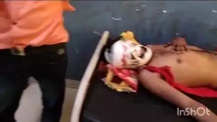 बांदा: शेखूपुर गांव के पास बाइक अनियंत्रित होकर फिसलकर गिरने से 2 बाइक सवार घायल, दोनों को जिला अस्पताल में कराया गया भर्ती