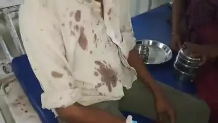 नरसिंहपुर: पत्नी को डांट रहे पति को पड़ोसी परिवार ने लोहे की रॉड से पीटा, घायल ज़िला अस्पताल रेफर