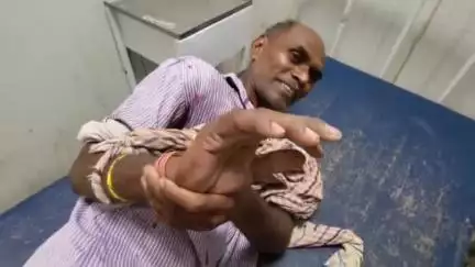 जहानाबाद: महमदपुर गांव में ईंट ढुलाई के दौरान एक व्यक्ति को जहरीले बिच्छू ने काटा, सदर अस्पताल में भर्ती
