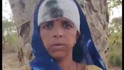 पाली: ग्राम पठराई निवासी महिला ने विपक्षियों पर लगाया घर के सामने से बकरियां निकालने के दौरान बेरहमी से मारपीट करने का आरोप