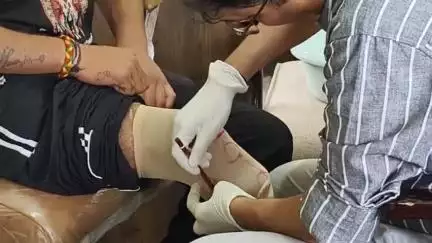 नाहन: रोटरी क्लब ने नाहन में कृत्रिम अंगों के नाप के लिए लगाया विशेष कैंप, करीब 3 दर्जन जरूरतमंद लोगों का लिया गया नाप