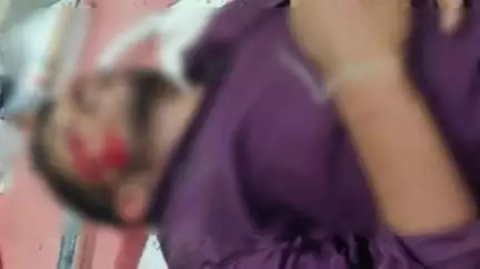 भंडारा: राज्य मार्गावरील करचखेडा येथे स्कुटीच्या अपघातात चालक गंभीर जखमी