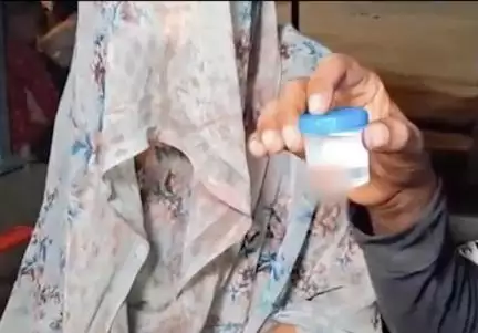 উত্তরপ্রদেশে প্রেমিকের সঙ্গে দেখা করতে যাওয়ায় স্ত্রীর নাক কামড়ে ছিঁড়ে নিল স্বামী
