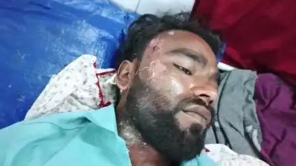 सिमरिया: बारिश की पहली फुहार के साथ हादसों का सिलसिला: मेंहेंद्रा खेरवा में बाइक पेड़ से टकराई, युवक घायल