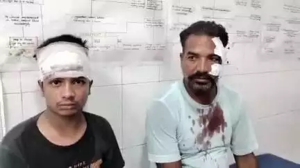 मुरादाबाद: सिविल लाइंस थाना क्षेत्र में बच्चों के बीच विवाद के बाद एक बच्चे के परिवार ने पिता-पुत्र के साथ की मारपीट