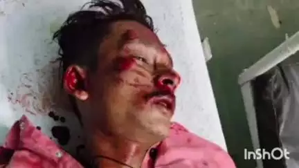कोंच: आंती पेट्रोल पंप के पास बाइक से गिरकर दो युवक घायल, एक मेडिकल कॉलेज रेफर