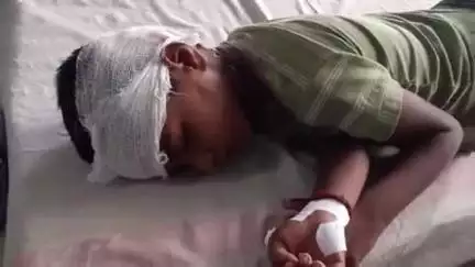बांधवगढ़: कृष्णा तालाब निवासी 7 वर्षीय बालक को अज्ञात वाहन ने मारी टक्कर, ज़िला अस्पताल के PICU वार्ड में भर्ती