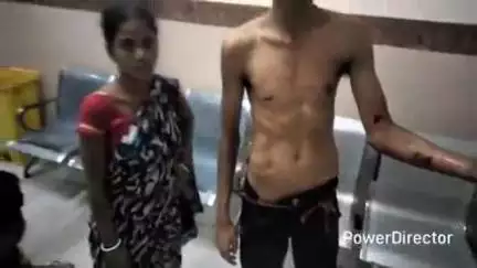 कटिहार: हरिगंज चौक पर दो पक्षों में मारपीट, एक व्यक्ति घायल, अस्पताल में भर्ती