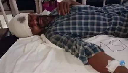 बांसवाड़ा: गराड़ीया गांव में जमीन विवाद के चलते बड़े भाई ने छोटे भाई को सिर पर लट्ठ मारकर किया घायल, एमजीएच में उपचार जारी