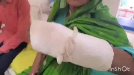 मुशहरी: महज एक ताड़ के फल के लिए पांच लोगों ने 70 वर्षीय वृद्धा को पीटा, हाथ तोड़ा और नाती को भी मारा