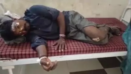 बुरहानपुर: बुरहानपुर- देड़तलाई रोड पर अज्ञात वाहन ने बाइक को मारी टक्कर, हादसे में एक युवक गंभीर रूप से घायल