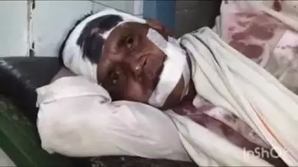 कोल: रोरावर में तैरईं कर घर लौट रहे परिवार के साथ दर्जनभर अज्ञात बाइक सवारों ने की मारपीट, 5 लोग घायल