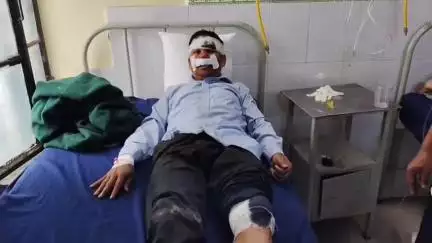 लोहाघाट के कोली ढेक में तेज रफ्तार स्कूटी ने राहगीर को मारी टक्कर गंभीर रूप से घायल। स्कूटी सवार फरार।