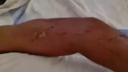 जगदीशपुर: पीडीएस घोटाले का विरोध करने पर भदौरिया गांव में वार्ड सदस्य के पति पर चाकू से जानलेवा हमला