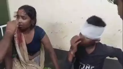 हमीरपुर: देवगांव में पानी के विवाद में दबंगों ने महिला पर कुल्हाड़ी से किया हमला, कानपुर रेफर