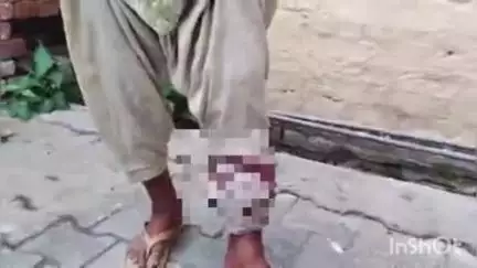 धौलाना: गांव गालंद निवासी एक बुजुर्ग महिला को पालतू कुत्ते ने काटा, परिजनों ने थाने में तहरीर देकर कार्रवाई की मांग की