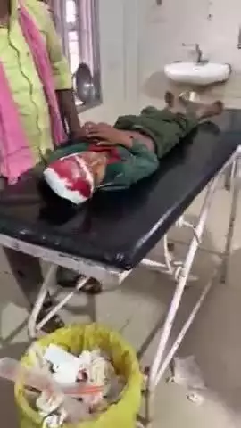 जतारा: गररौली गांव में जामुन के पेड़ से गिरा 5 वर्षीय बच्चा, गंभीर हालत में झांसी किया गया रेफर