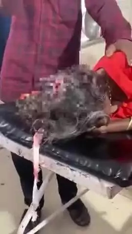 टीकमगढ़: हीरापुर गांव में भैंस के हमले से 70 वर्षीय वृद्धा घायल, सिर में आई गंभीर चोटें