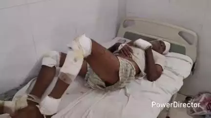 मऊ: कर्वी के लौढ़िया मोड़ के पास बाइक की टक्कर से बाइक सवार व्यक्ति घायल, जिला अस्पताल में भर्ती