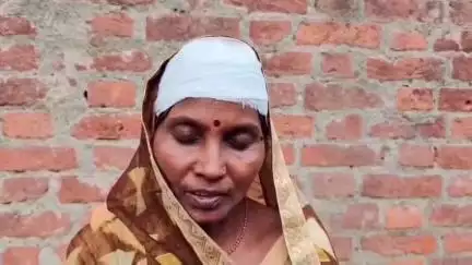 बेल्थरा रोड: शाहपुर टिटिहा गांव निवासी महिला के सिर में लगे 32 टांके, मुकदमा दर्ज होने के बावजूद विपक्षी दे रहा धमकी
