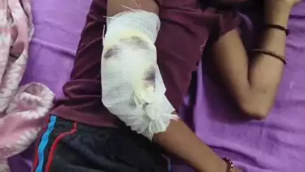 डूंगरपुर: वाड़ा पुनाली गांव में सोमवार दोपहर बड़ा हादसा, निर्माणाधीन मकान का पिलर गिरने से भाई-बहन घायल, भाई की हुई मौत