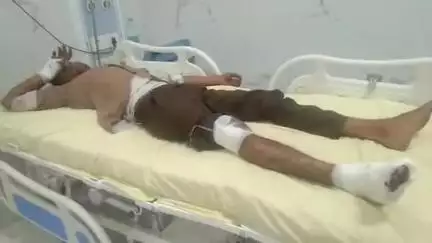 हमीरगढ़: मंडपिया में रोड पर अचानक पशु के आने से बाइक सवार अनियंत्रित होकर पशु से टकराया, घायल जिला चिकित्सालय में भर्ती