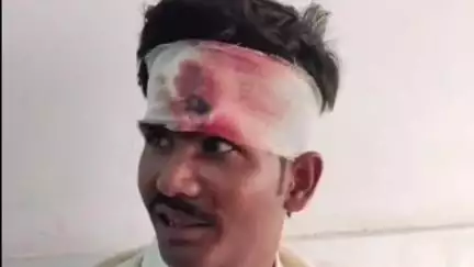 शाहबाद: लोक निर्माण विभाग के गेस्ट हाउस के सामने वाहन चेकिंग से बचने में बाइक सवार फिसल गया, घायल
