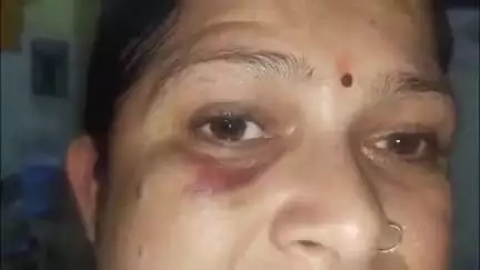 किलौली के पास ओवरटेक करने के चक्कर में 2 कारों में हुई टक्कर, 3 लोग हुए घायल