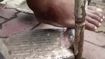 তুফানগঞ্জ ১: রামহরি মোড় এলাকায় বিল্ডিং এর কাজ করতে গিয়ে পড়ে গিয়ে পা ভাংলো শ্রমিকের, রেফার জেলা হাসপাতালে