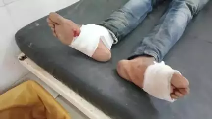 पन्ना: पन्ना-कटनी मार्ग पर अज्ञात वाहन की टक्कर से बाइक सवार 3 लोग हुए घायल, मामला दर्ज