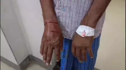 బెల్లంపల్లి: బెల్లంపల్లి పట్టణం బెల్లంపల్లి బస్తి, బూడిది గడ్డ బస్తీలలో పిచ్చికుక్కల దాడిలో గాయపడ్డ ఇరువురు