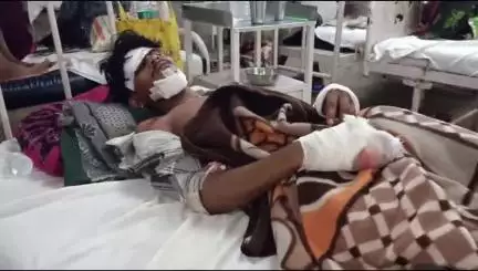 बांसवाड़ा: वाडगुन गांव में बाइक को अज्ञात वाहन ने मारी टक्कर, युवक को दोनों हाथ और चेहरे पर लगी चोट, एमजी अस्पताल में उपचार जारी