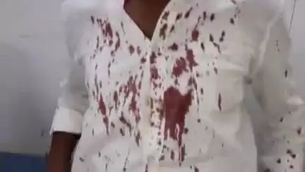 అనంతపురం నగరంలోని కళ్యాణదుర్గం బైపాస్ రోడ్డులో వ్యక్తిపై బీరు బాటిల్ తో దాడి