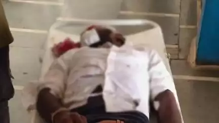 छपारा: सादक सिवनी गांव के पास एनएच-44 पर अज्ञात वाहन की टक्कर से घायल हुआ बाइक सवार युवक, अस्पताल में कराया गया भर्ती