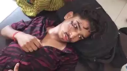 खालवा: खालवा रोड पर सड़क हादसे में युवक घायल