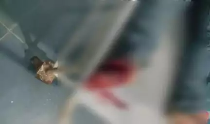 বান্দোয়ান: মাংলা গ্রামের স্কুল সংলগ্ন রাস্তায় পথ দুর্ঘটনায় আহত দুই ব্যক্তি
