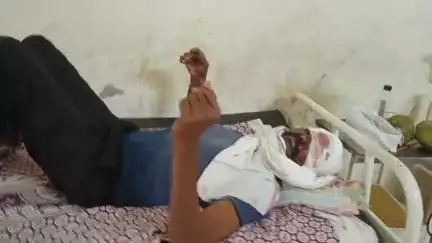 बुरहानपुर नगर: बुरहानपुर इच्छापुर के पास मोटरसाइकिल की टक्कर में एक युवक घायल, ज़िला अस्पताल में भर्ती