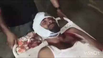 कोल: रसलगंज में तेज रफ्तार कार ने बाइक सवार युवक को रौंदा, घायल को स्थानीय लोगों ने गंभीर हालत में पहुँचाया अस्पताल