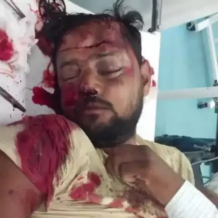दुर्गावती: महमूदगंज बाजार के पास सड़क दुर्घटना में एक अज्ञात युवक गंभीर रूप से घायल, पहचान कराने में जुटी दुर्गावती पुलिस