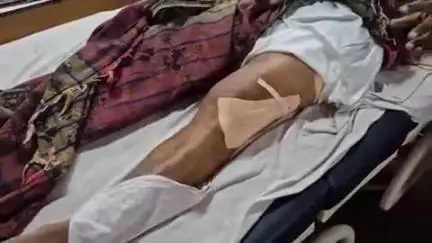 लाडपुरा: सांगोद थाना इलाके के श्यामपुरा गांव में काम करते समय ट्रैक्टर की टक्कर से युवक हुआ घायल, मेडिकल कॉलेज अस्पताल में भर्ती
