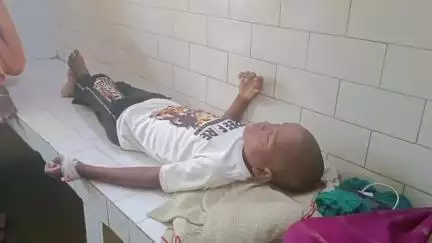 दुधि: दुद्धी में अलग-अलग जगहों पर एक मासूम बालक समेत तीन लोग हुए सर्पदंश का शिकार, अस्पताल में इलाज जारी