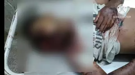 পুরুলিয়া ২: মফস্বল থানার গোলবেড়ার কাছে পথ দুর্ঘটনায় বাইক আরোহী যুবকের মৃত্যু, সম্পন্ন হল ময়নাতদন্ত