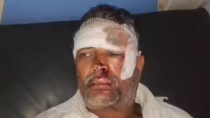 टीकमगढ़: गुदनवारा गांव में गाय को बचाने में हादसा, दो गंभीर घायल, उपचार जारी