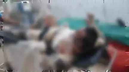 पाली: गुड़ा जाटान में प्रेमिका ने मिलने से मना किया तो प्रेमी ने अपने पर पेट्रोल डालकर खुद को आग के हवाले किया