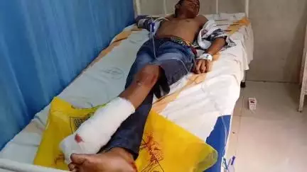 बेतिया: ट्रेन से कटा युवक का पैर, नाज़ुक हालत में जीएमसीएच में भर्ती