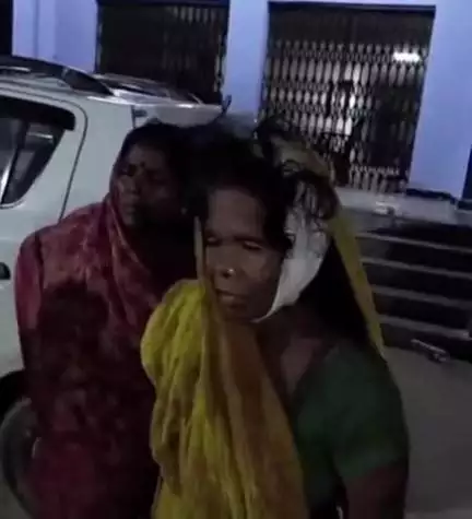 उजियारपुर: उजियारपुर थाना क्षेत्र के बेलारी में आपसी विवाद में मारपीट, महिलाएं हुईं जख्मी