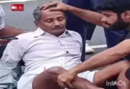 ಕಾಪು: ಎರ್ಮಾಳಿನಲ್ಲಿ ಬಸ್-ಸ್ಕೂಟರ್ ಮಧ್ಯೆ ಡಿಕ್ಕಿ, ಸವಾರನ ಕಾಲಿಗೆ ಗಂಭೀರ ಗಾಯ